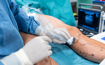 عقب زدگی زانو؛ علل، علائم، تشخیص و درمان