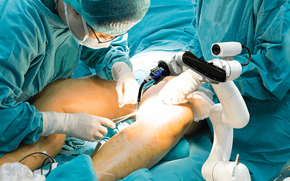 شکستگی استخوان ران